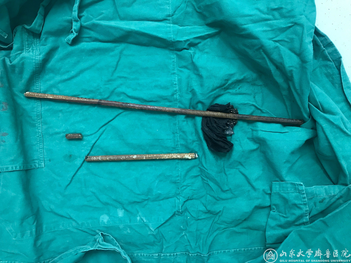 蒲京娱乐场网站急诊团队6小时手术挽回钢筋贯穿伤患者生命